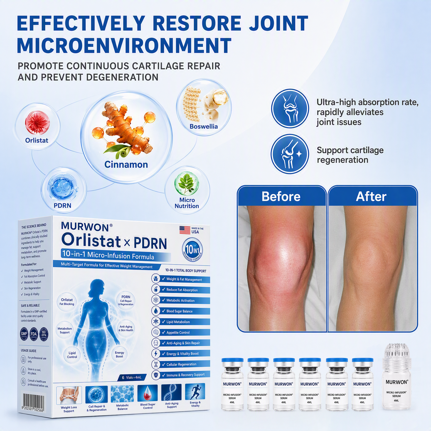 💕Latest 2026 Scientific Research |𝑴𝑼𝑹𝑾𝑶𝑵® Orlistat × PDRN 10-in-1 Micro-Infusion Formula|For weight loss/skin tightening/blood sugar balance|Zero Pain, No Side Effects
