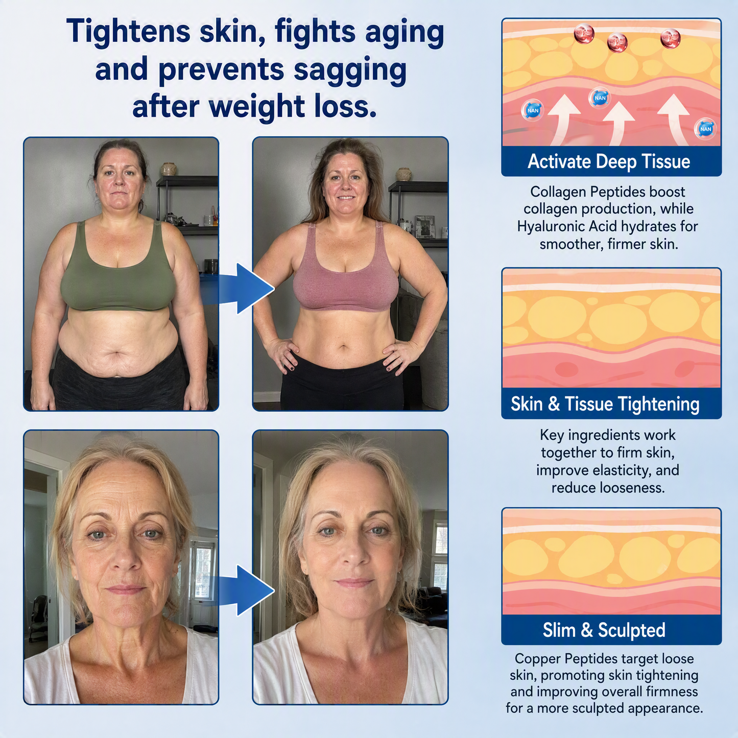 💕Latest 2026 Scientific Research |𝑴𝑼𝑹𝑾𝑶𝑵® Orlistat × PDRN 10-in-1 Micro-Infusion Formula|For weight loss/skin tightening/blood sugar balance|Zero Pain, No Side Effects
