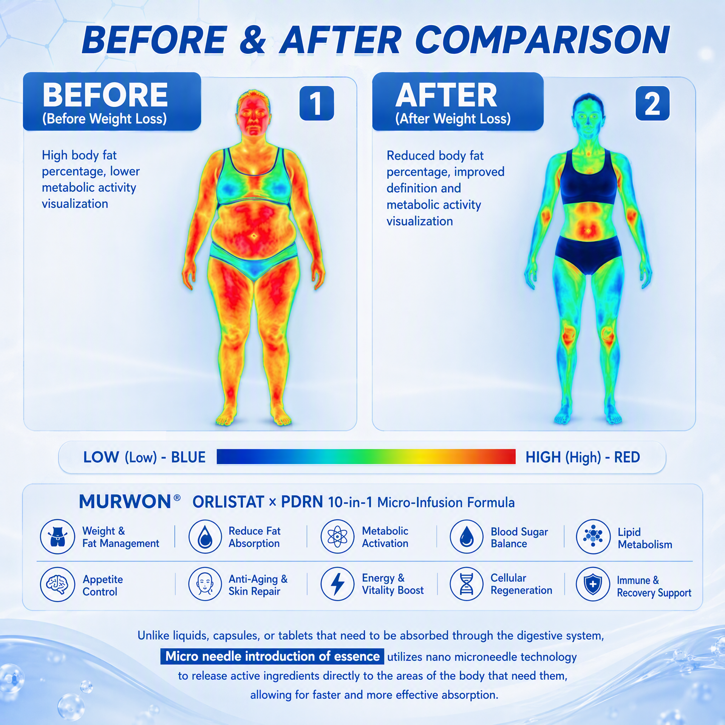 💕Latest 2026 Scientific Research |𝑴𝑼𝑹𝑾𝑶𝑵® Orlistat × PDRN 10-in-1 Micro-Infusion Formula|For weight loss/skin tightening/blood sugar balance|Zero Pain, No Side Effects