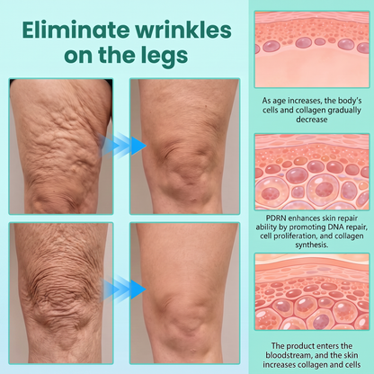 Vitalisys® PDRN Complex Peptide Capsule Cream|Anti aging, firming and lifting muscles Skin care, removal of stretch marks, breast enhancement, removal of chest lines, and skin repair.