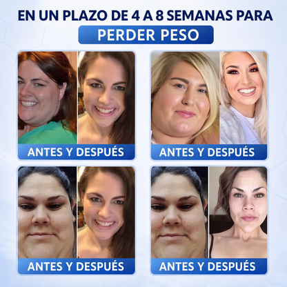 💕Latest 2026 Scientific Research |𝑴𝑼𝑹𝑾𝑶𝑵® Orlistat × PDRN 10-in-1 Micro-Infusion Formula|For weight loss/skin tightening/blood sugar balance|Zero Pain, No Side Effects