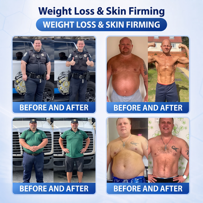 💕Latest 2026 Scientific Research |𝑴𝑼𝑹𝑾𝑶𝑵® Orlistat × PDRN 10-in-1 Micro-Infusion Formula|For weight loss/skin tightening/blood sugar balance|Zero Pain, No Side Effects