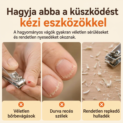 💎💎Időkorlátos Ajánlat⏰2 az 1-ben Intelligens Elektromos Körömvágó és -Polírozó Minden Korosztály Számára 👨‍👩‍👧‍👦 – Penge-, Vér- és Stresszmentes Körmös Ápolás! 💅