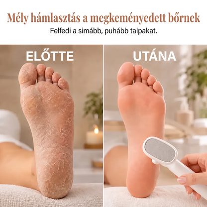 🌈🌈LEFUN® Precíziós lábreszelő 🌟 eltávolítja az érdes és megkeményedett bőrt, segít simává tenni a sarkat, és lehetővé teszi, hogy kényelmesen, otthon végezd a lábápolást