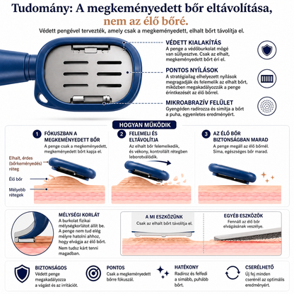 🔥🔥LEFUN® Precíziós lábreszelő 🌟 eltávolítja az érdes és megkeményedett bőrt, segít simává tenni a sarkat, és lehetővé teszi, hogy kényelmesen, otthon végezd a lábápolást