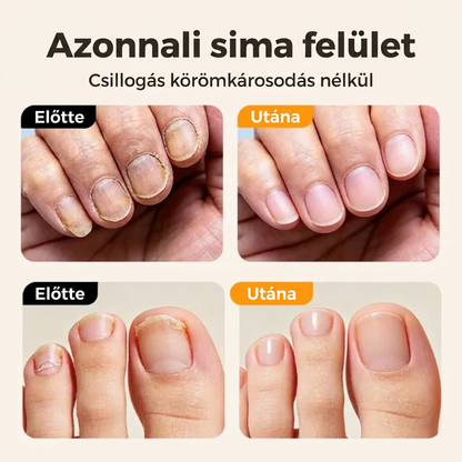 💎💎Időkorlátos Ajánlat⏰2 az 1-ben Intelligens Elektromos Körömvágó és -Polírozó Minden Korosztály Számára 👨‍👩‍👧‍👦 – Penge-, Vér- és Stresszmentes Körmös Ápolás! 💅