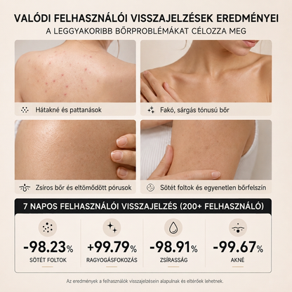 🔥🔥Vitalisys® Niacinamidos bőrvilágosító szappan pigmentfoltok és szeplők ellen 💆‍♀️