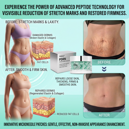 Vitalisys® PDRN Complex Peptide Capsule Cream|Anti aging, firming and lifting muscles Skin care, removal of stretch marks, breast enhancement, removal of chest lines, and skin repair.