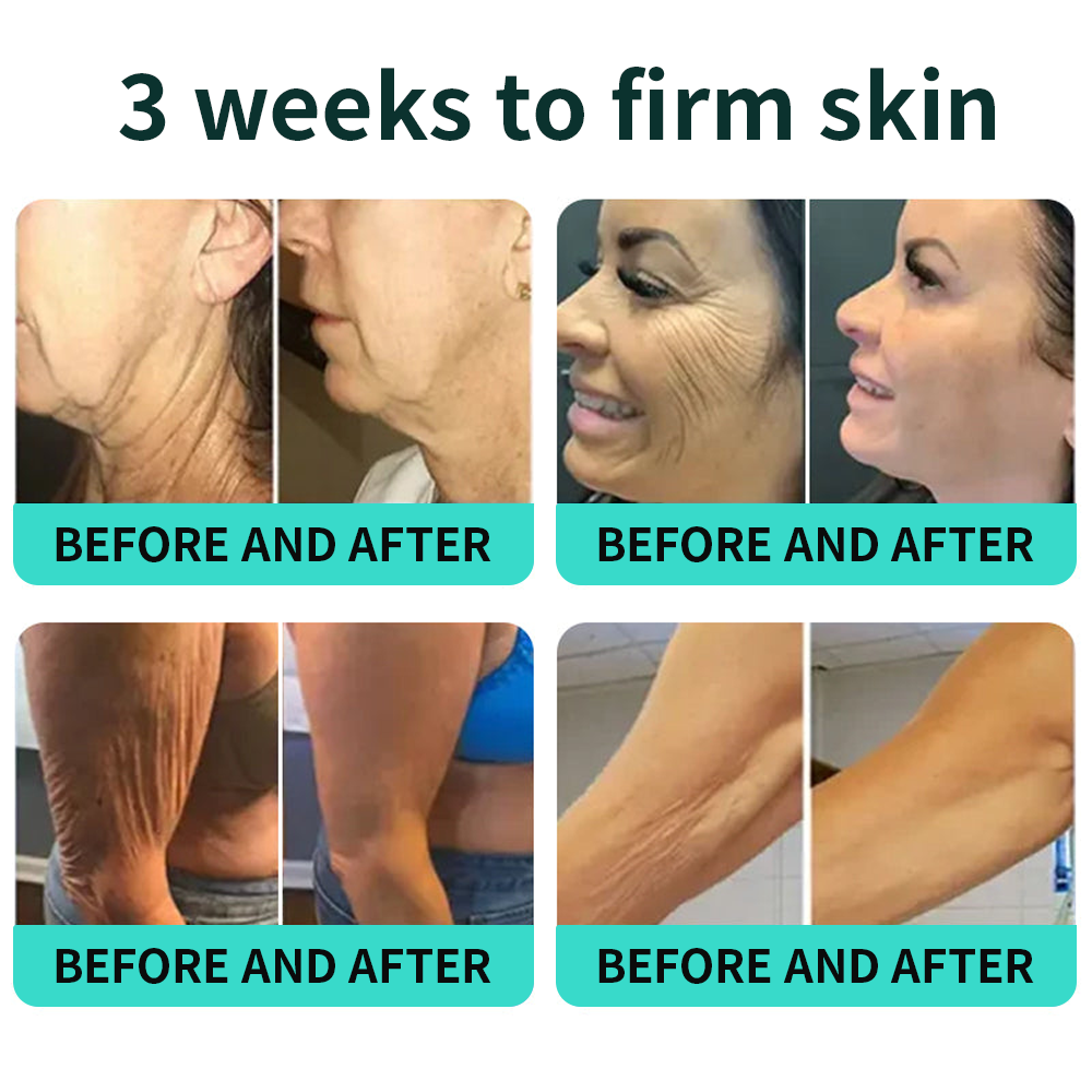 Vitalisys® PDRN Complex Peptide Capsule Cream|Anti aging, firming and lifting muscles Skin care, removal of stretch marks, breast enhancement, removal of chest lines, and skin repair.